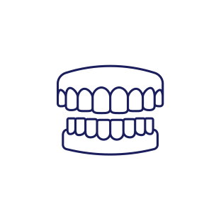 入れ歯やブリッジではいけないのですか?